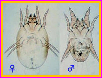 ความรู้เกี่ยวกับไรฝุ่น (Knowledge about Dust Mite) 3