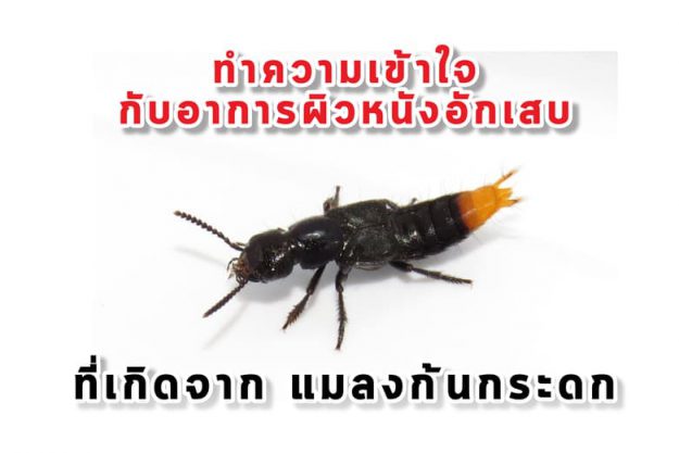 ทำความเข้าใจกับอาการผิวหนังอักเสบ ที่เกิดจาก แมลงก้นกระดก