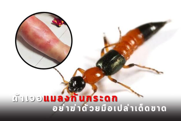 รู้เอาไว้ถ้าเจอ แมลงก้นกระดก อย่าฆ่าด้วยมือเปล่าเด็ดขาด